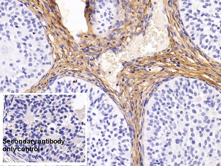 Monoclonal Antibody to Procollagen III N-Terminal Propeptide (PIIINP)