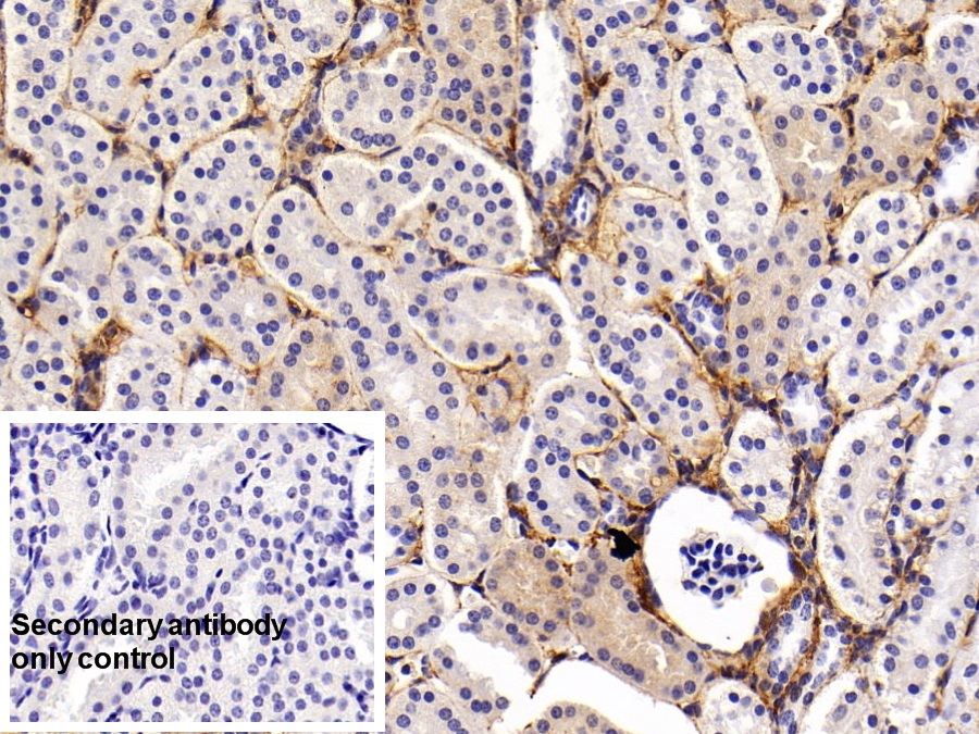 Monoclonal Antibody to Procollagen III N-Terminal Propeptide (PIIINP)