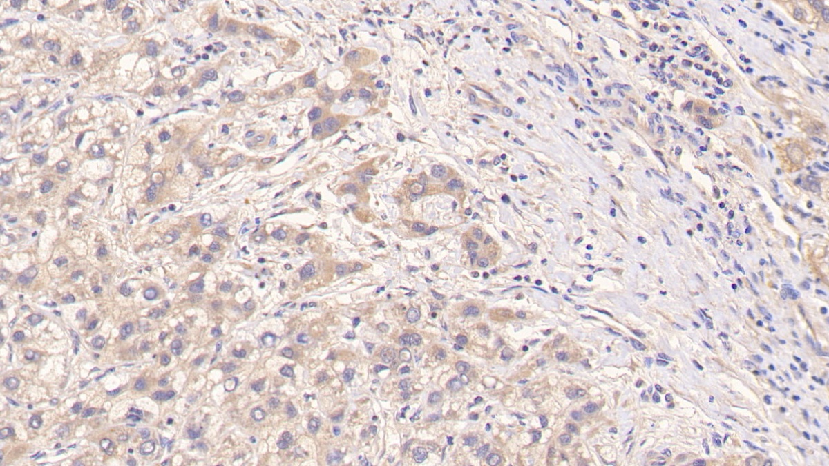 Monoclonal Antibody to Procollagen III N-Terminal Propeptide (PIIINP)