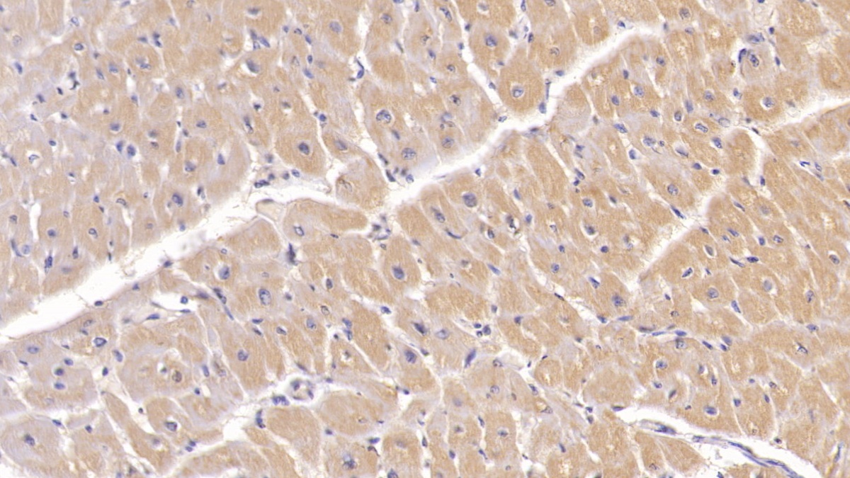 Monoclonal Antibody to Procollagen III N-Terminal Propeptide (PIIINP)