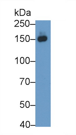 Monoclonal Antibody to Procollagen III N-Terminal Propeptide (PIIINP)