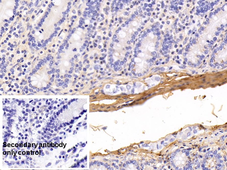 Monoclonal Antibody to Procollagen III N-Terminal Propeptide (PIIINP)