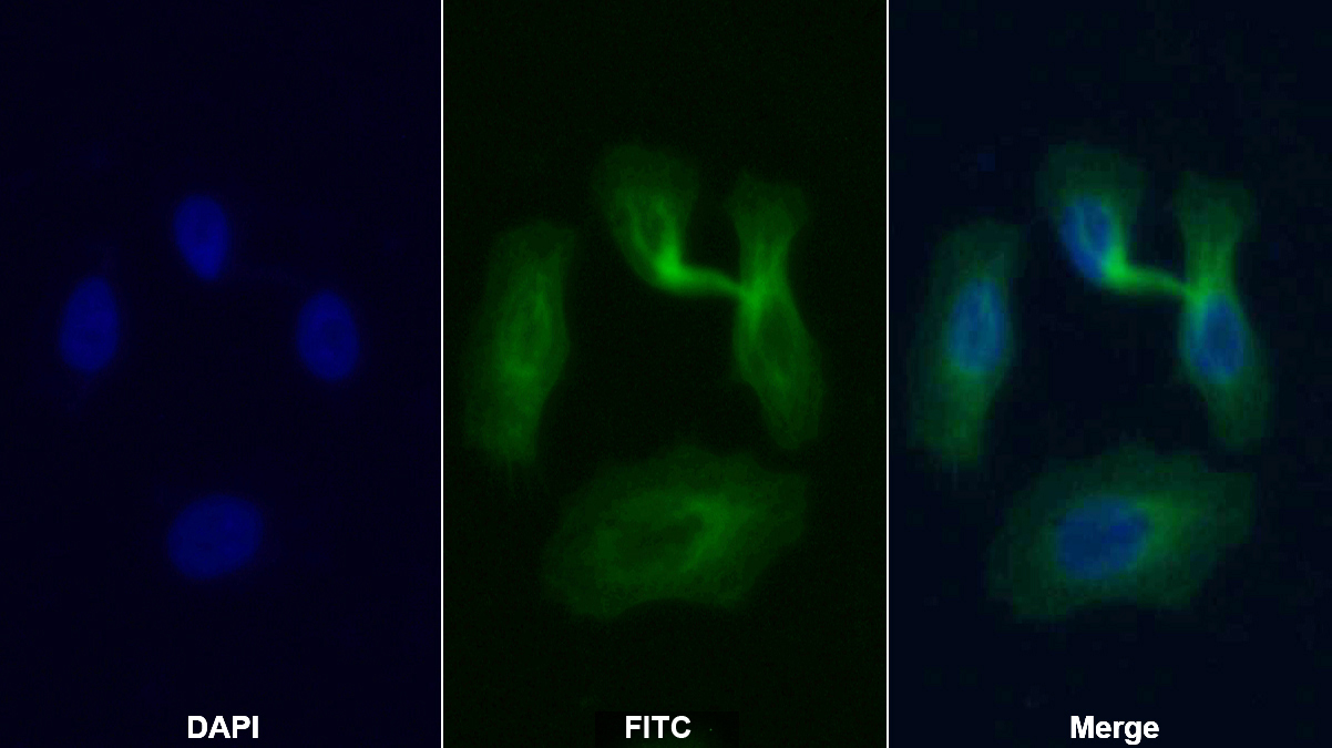 Monoclonal Antibody to Procollagen III N-Terminal Propeptide (PIIINP)