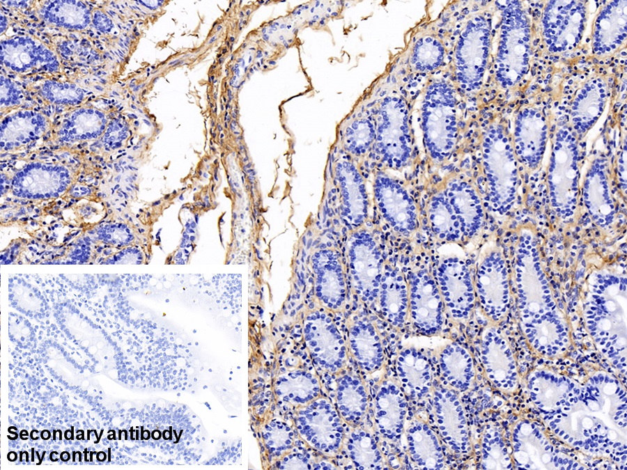 Monoclonal Antibody to Procollagen III N-Terminal Propeptide (PIIINP)