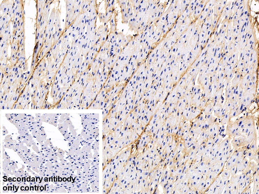 Monoclonal Antibody to Procollagen III N-Terminal Propeptide (PIIINP)