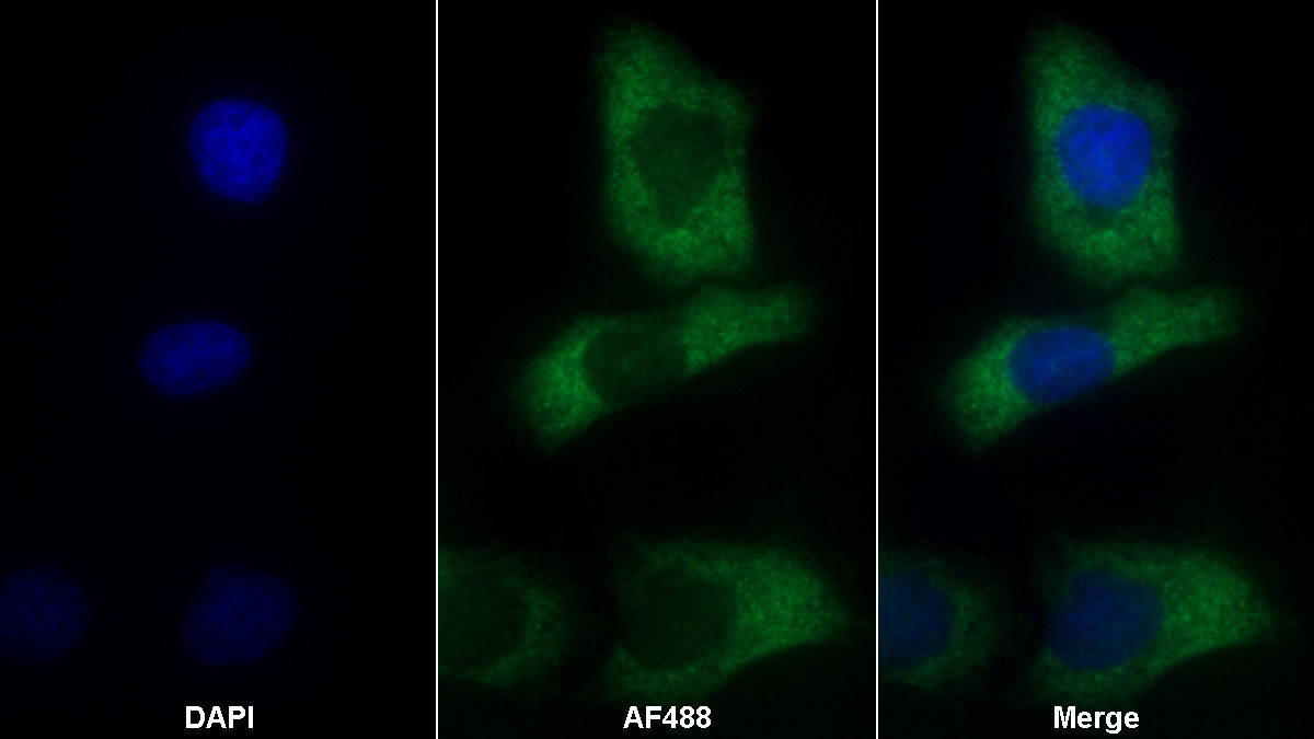 Monoclonal Antibody to Procollagen III N-Terminal Propeptide (PIIINP)