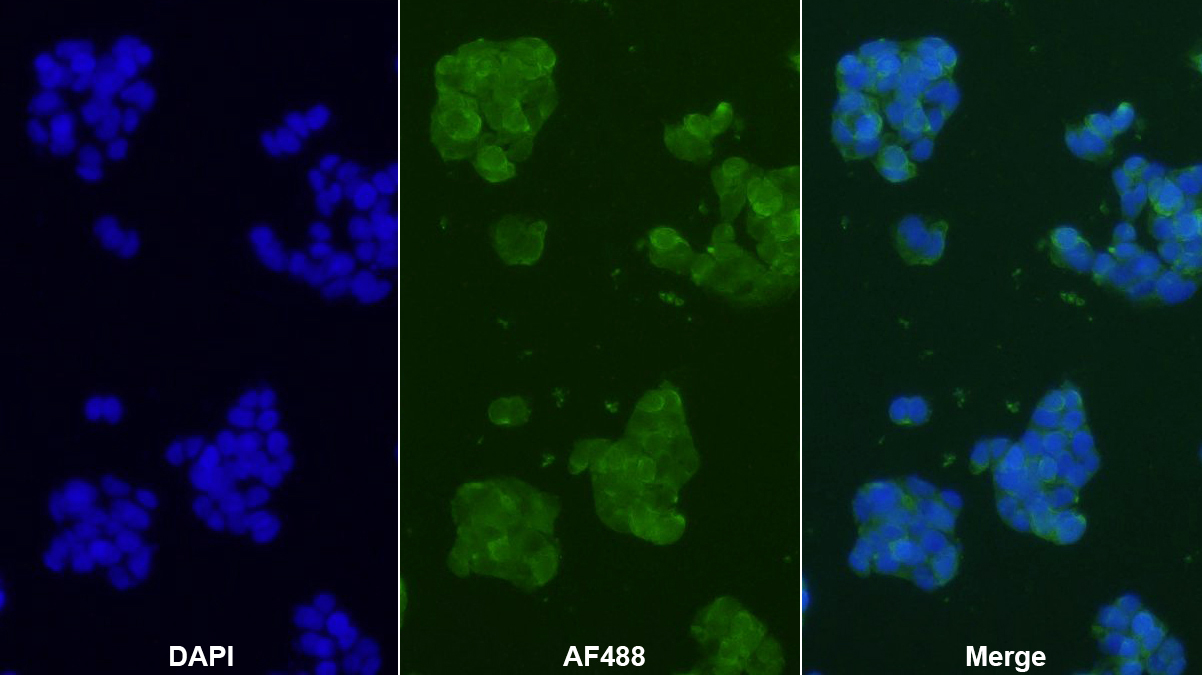 Monoclonal Antibody to Procollagen III N-Terminal Propeptide (PIIINP)