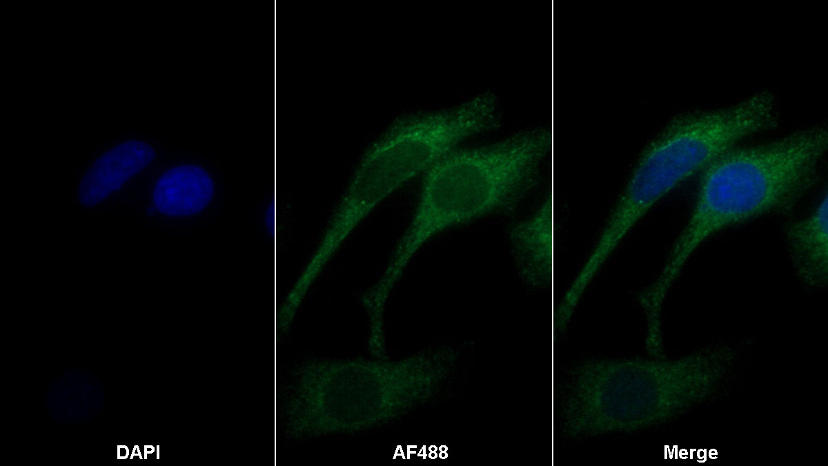 Monoclonal Antibody to Procollagen III N-Terminal Propeptide (PIIINP)