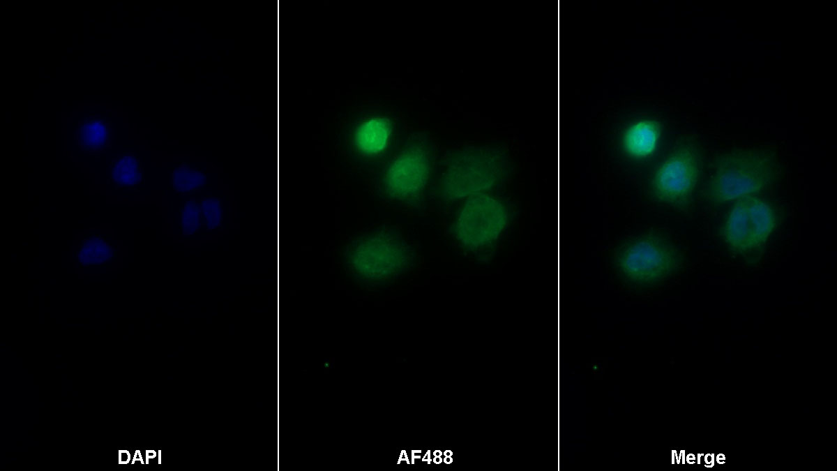 Monoclonal Antibody to Aquaporin 4 (AQP4)