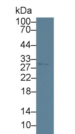 Monoclonal Antibody to Heme Oxygenase 1 (HO1)