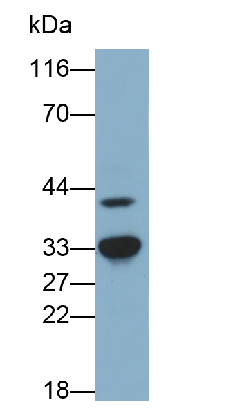 Monoclonal Antibody to Heme Oxygenase 1 (HO1)