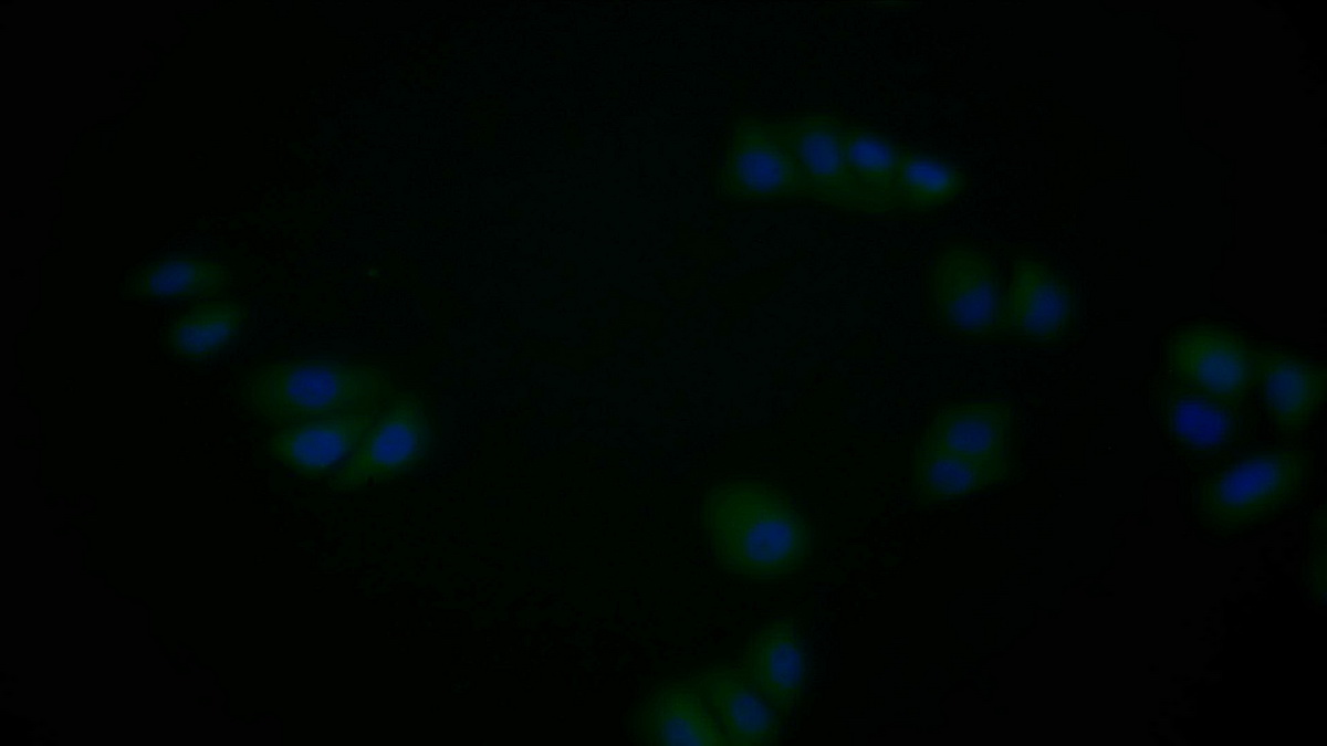 Monoclonal Antibody to Proliferating Cell Nuclear Antigen (PCNA)