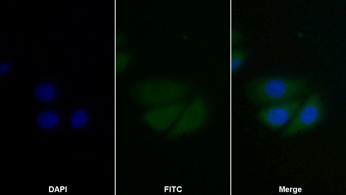 Monoclonal Antibody to Proliferating Cell Nuclear Antigen (PCNA)