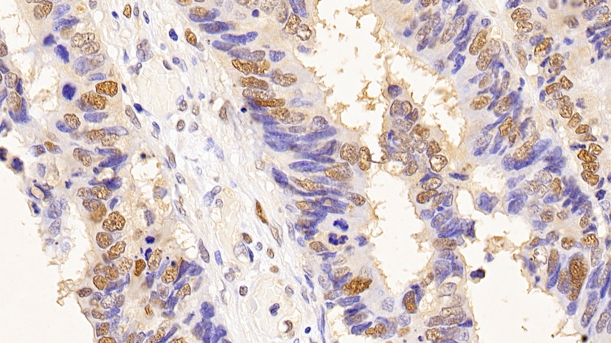 Monoclonal Antibody to Proliferating Cell Nuclear Antigen (PCNA)