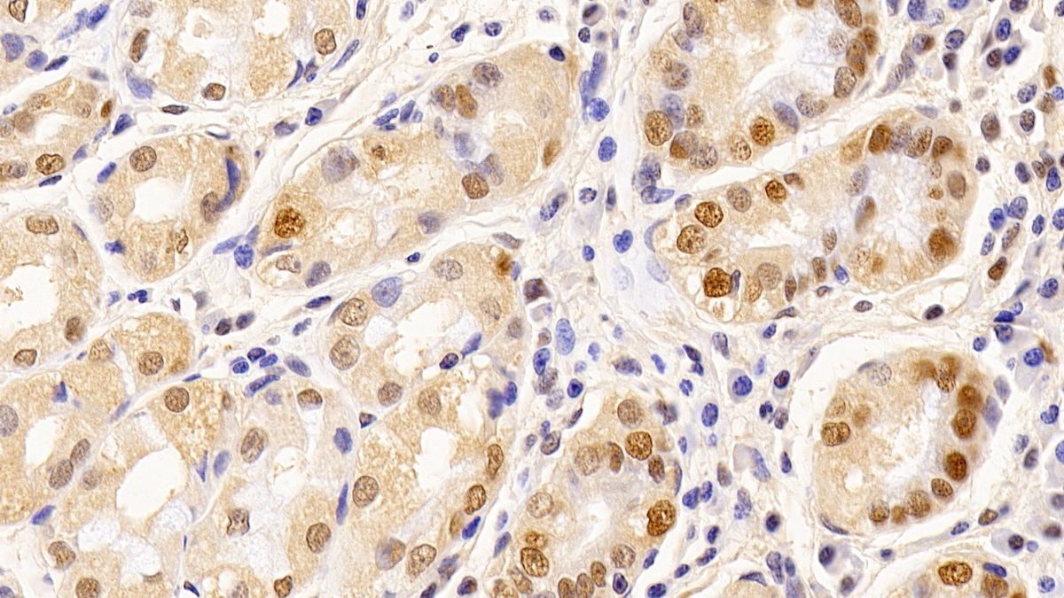 Monoclonal Antibody to Proliferating Cell Nuclear Antigen (PCNA)