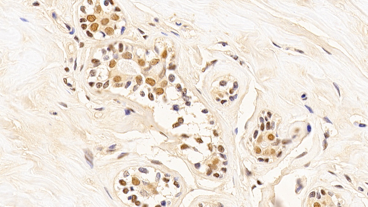 Monoclonal Antibody to Proliferating Cell Nuclear Antigen (PCNA)