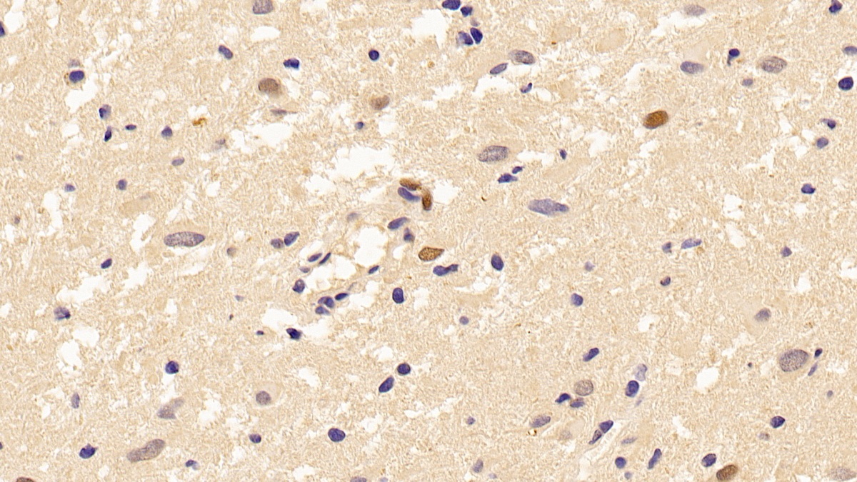 Monoclonal Antibody to Proliferating Cell Nuclear Antigen (PCNA)