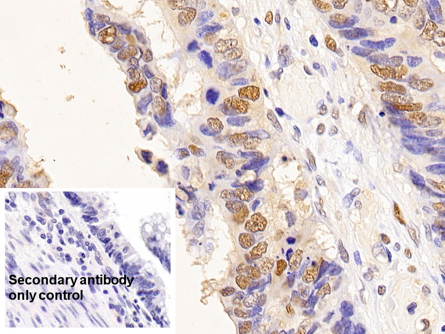 Monoclonal Antibody to Proliferating Cell Nuclear Antigen (PCNA)