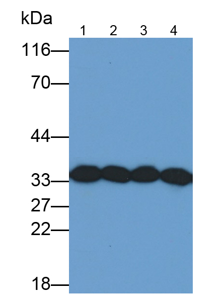 Monoclonal Antibody to Proliferating Cell Nuclear Antigen (PCNA)