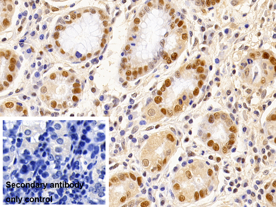Monoclonal Antibody to Proliferating Cell Nuclear Antigen (PCNA)