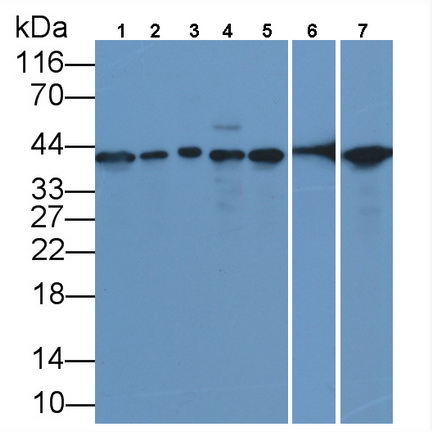 Monoclonal Antibody to Proliferating Cell Nuclear Antigen (PCNA)