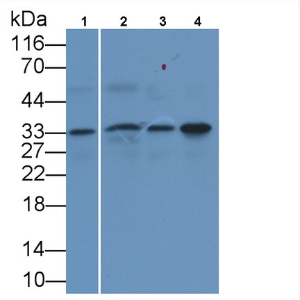 Monoclonal Antibody to Proliferating Cell Nuclear Antigen (PCNA)