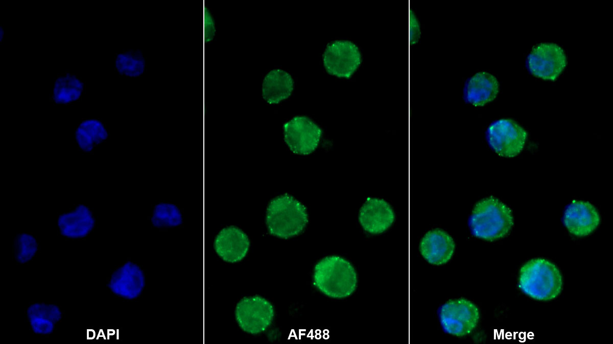 Monoclonal Antibody to Myeloperoxidase (MPO)