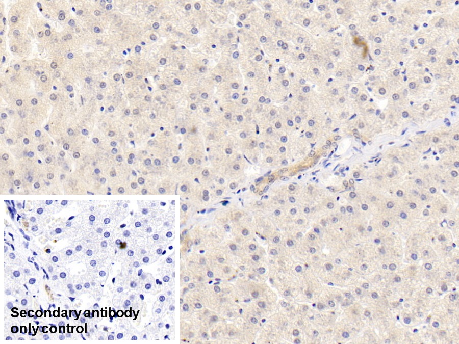 Monoclonal Antibody to Apolipoprotein B100 (APOB100)