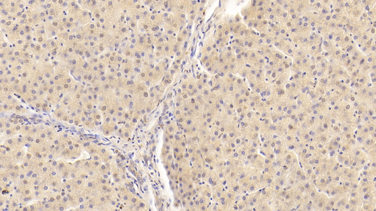 Monoclonal Antibody to Apolipoprotein B100 (APOB100)