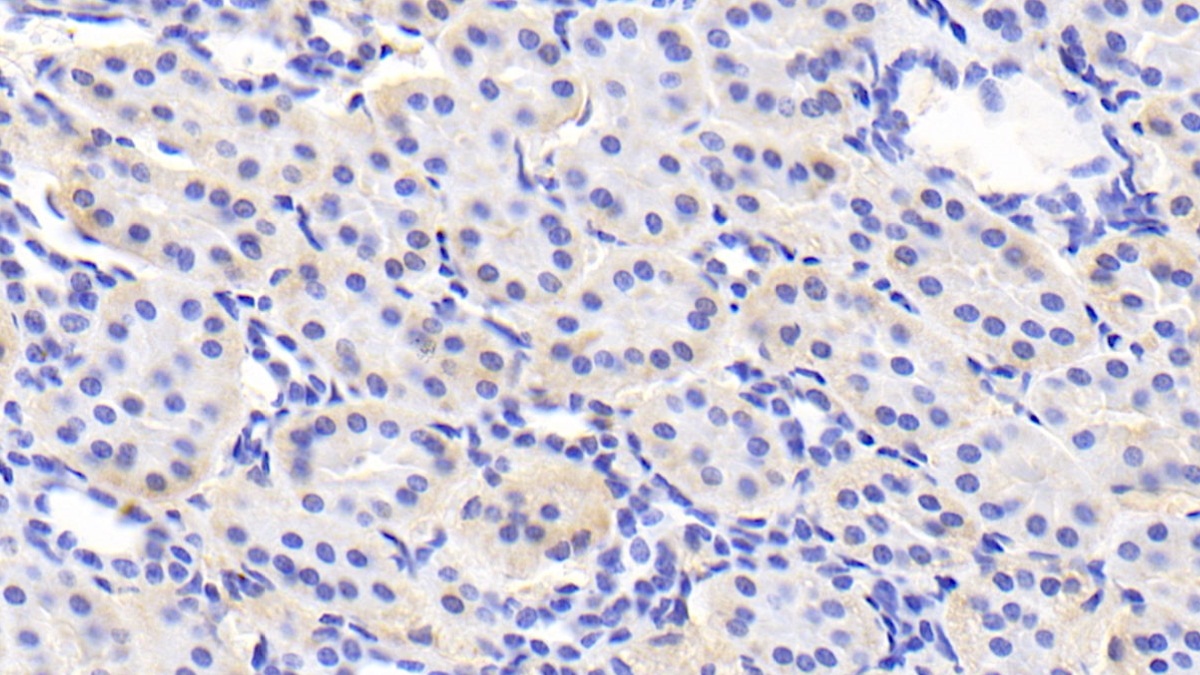 Monoclonal Antibody to Adiponectin (ADPN)