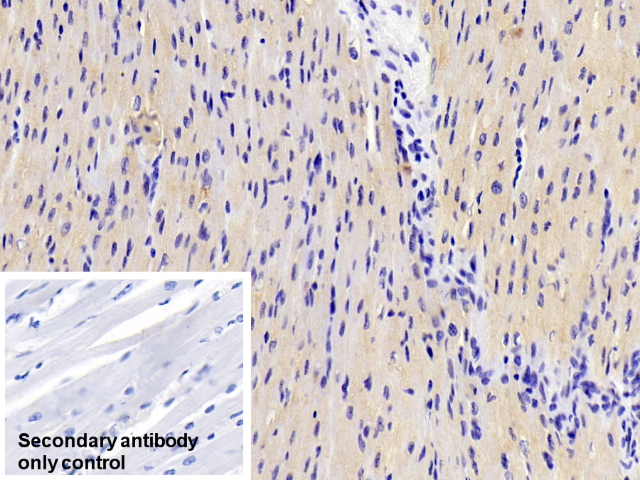 Monoclonal Antibody to Adiponectin (ADPN)