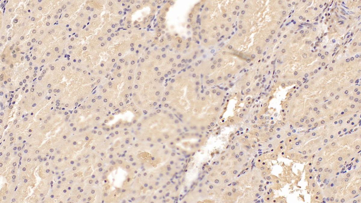 Monoclonal Antibody to Adiponectin (ADPN)