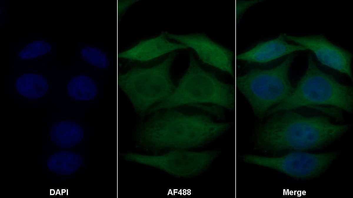 Monoclonal Antibody to Glutathione S Transferase Alpha 1 (GSTa1)