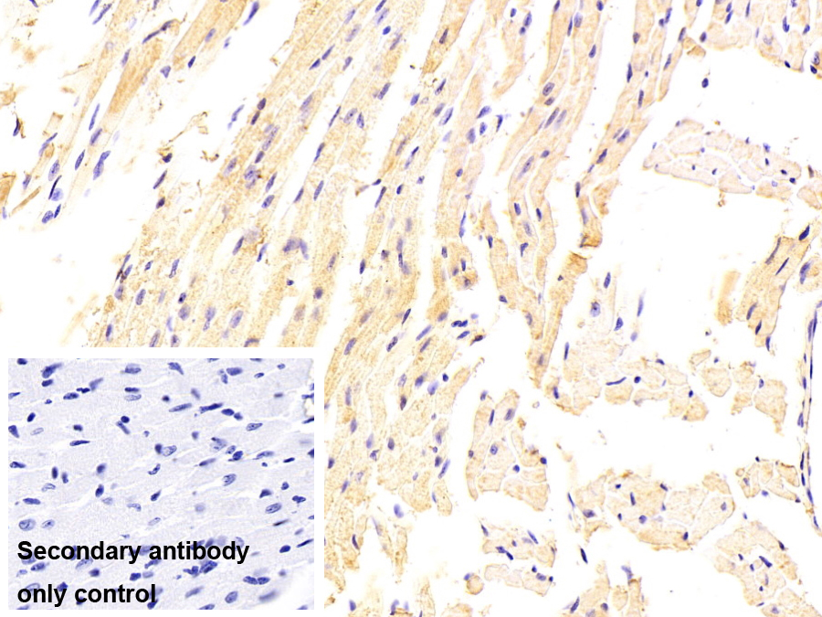 Monoclonal Antibody to Glutathione S Transferase Theta 1 (GSTt1)