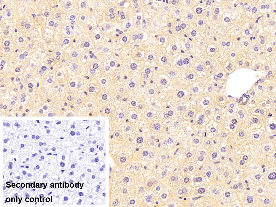 Monoclonal Antibody to Glutathione S Transferase Theta 1 (GSTt1)