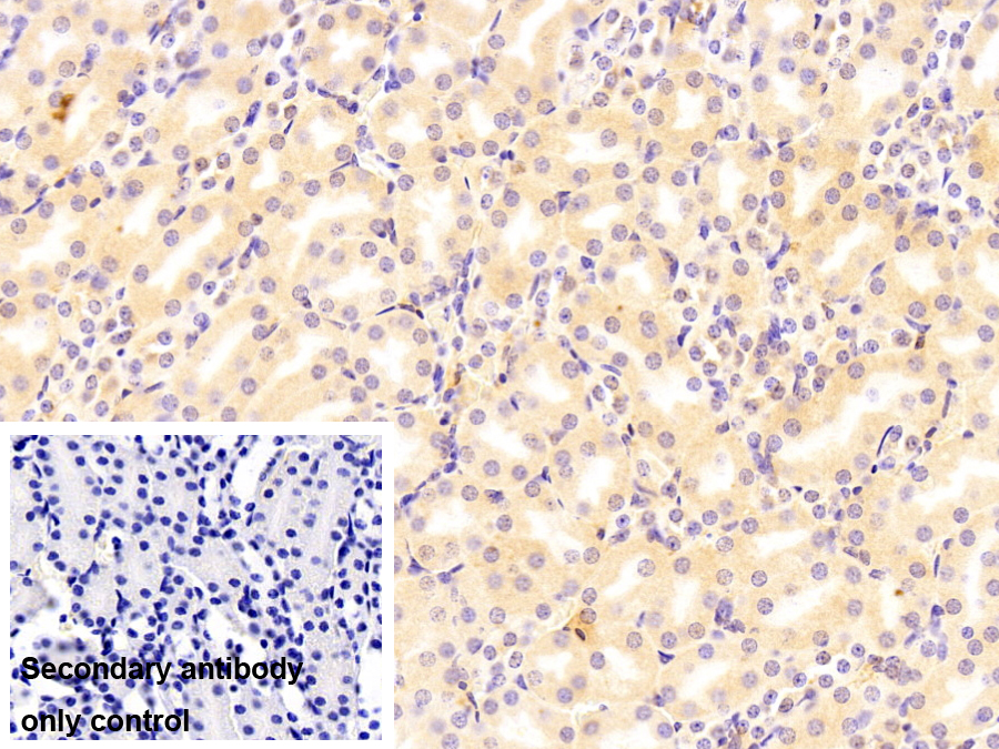 Monoclonal Antibody to Glutathione S Transferase Theta 1 (GSTt1)
