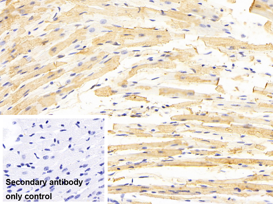 Monoclonal Antibody to Glutathione S Transferase Theta 1 (GSTt1)
