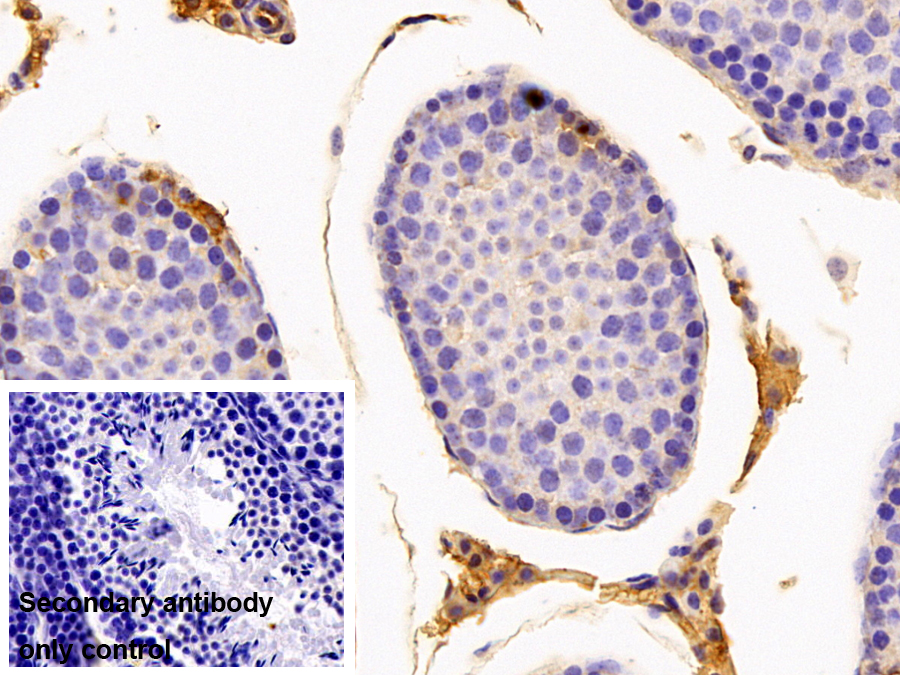 Monoclonal Antibody to Glutathione S Transferase Theta 1 (GSTt1)