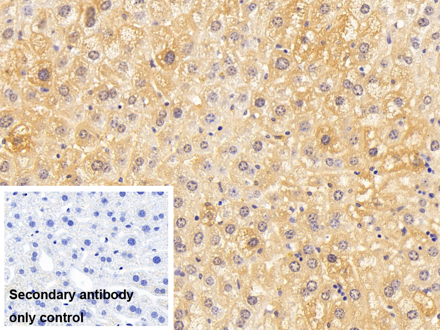 Monoclonal Antibody to Glutathione S Transferase Theta 1 (GSTt1)