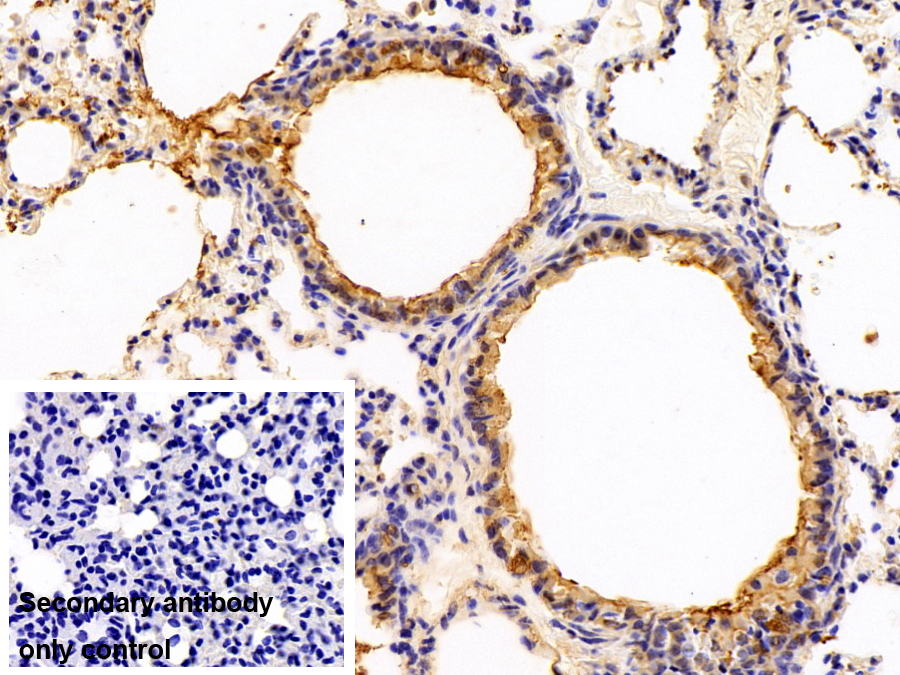 Monoclonal Antibody to Glutathione S Transferase Theta 1 (GSTt1)