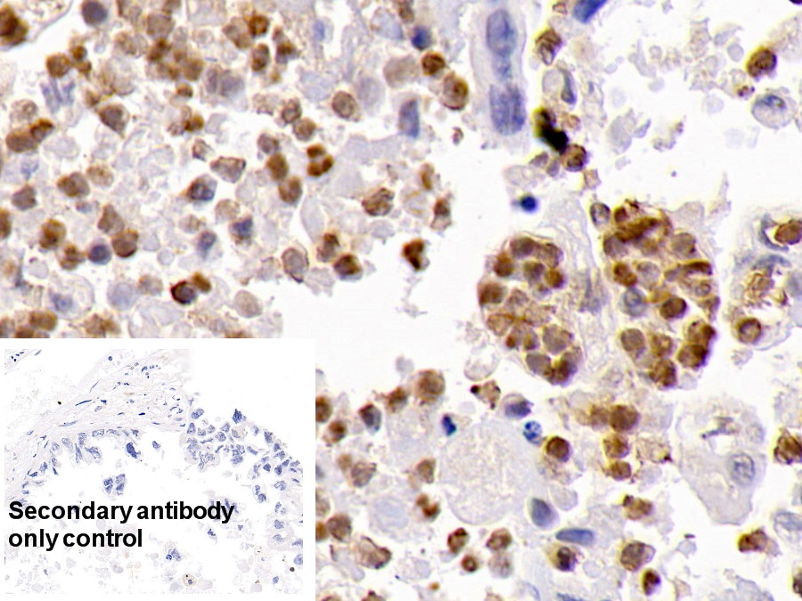 Monoclonal Antibody to Caspase 3 (CASP3)