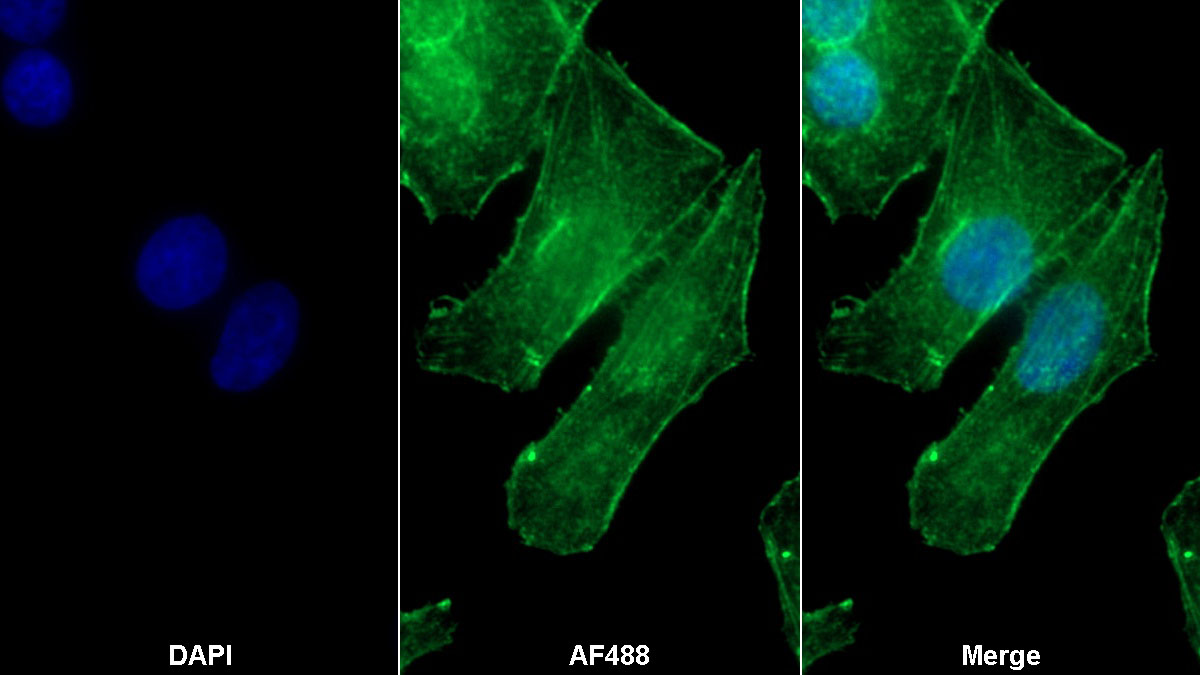 Monoclonal Antibody to BH3 Interacting Domain Death Agonist (Bid)