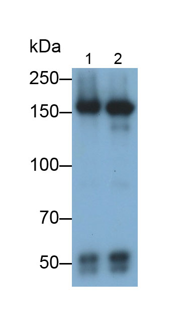 Monoclonal Antibody to Complement Factor H (CFH)