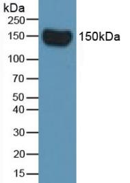 Monoclonal Antibody to Complement Factor H (CFH)