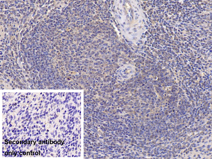 Monoclonal Antibody to Visfatin (VF)