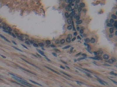 Monoclonal Antibody to Cross Linked N-Telopeptide Of Type I Collagen (NTXI)