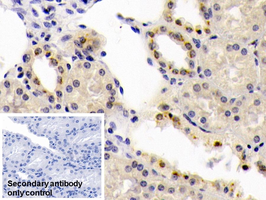 Monoclonal Antibody to Bone Morphogenetic Protein 6 (BMP6)