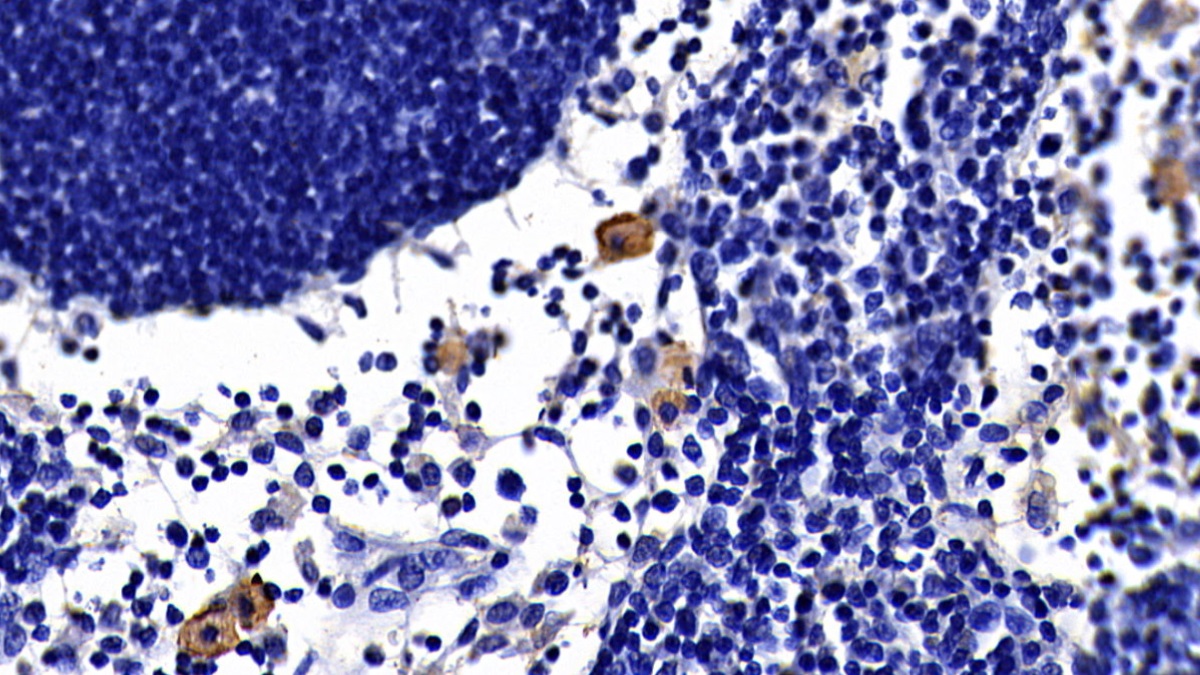 Monoclonal Antibody to Toll Like Receptor 2 (TLR2)