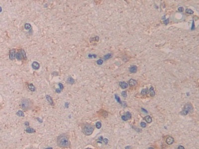 Monoclonal Antibody to Cross Linked C-Telopeptide Of Type I Collagen (CTXI)