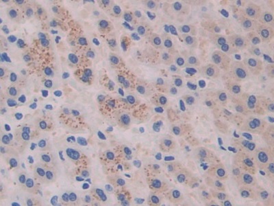 Monoclonal Antibody to Cross Linked C-Telopeptide Of Type I Collagen (CTXI)